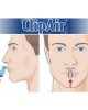 Oscimed ClipAir® Ρινικός Διαστολέας για το Ροχαλητό
